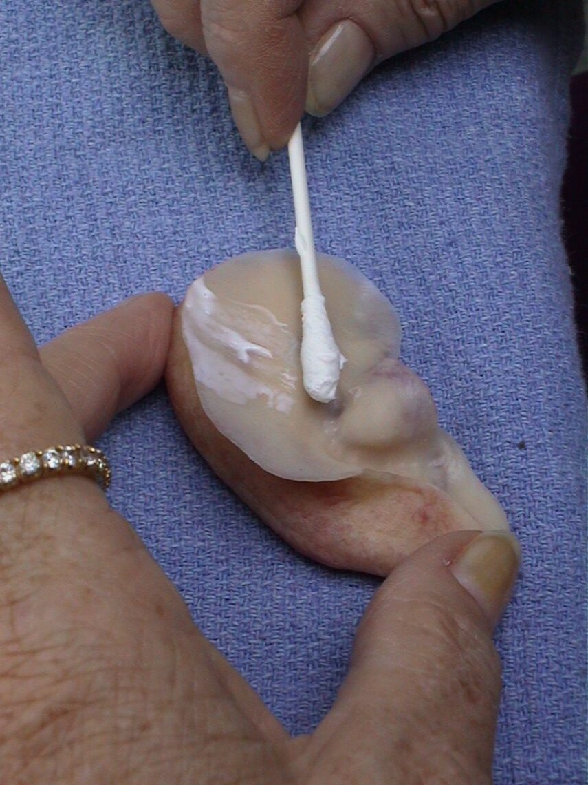 Prosthetic ear mold
