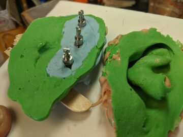 Prosthetic ears molds