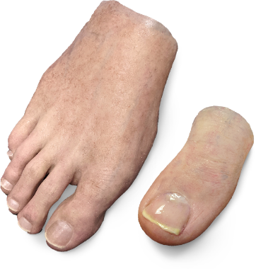Prosthetic ears for foot