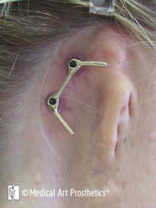 a close-up of a person's ear