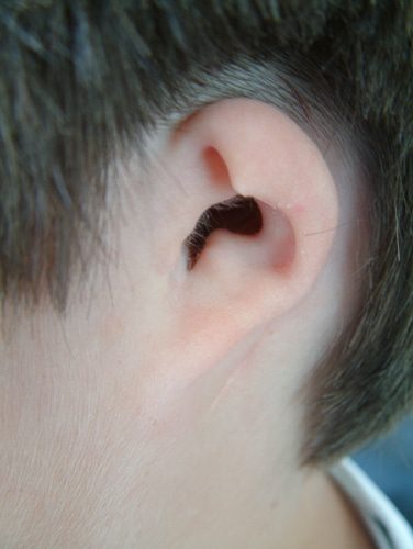 Prosthetic ear close-up