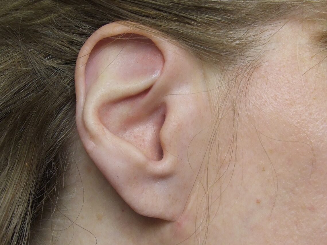 Prosthetic ear