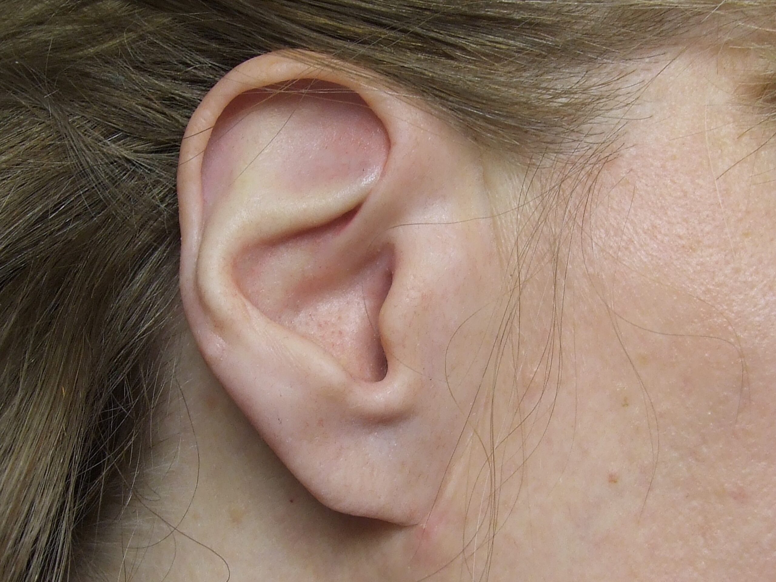 Prosthetic ear